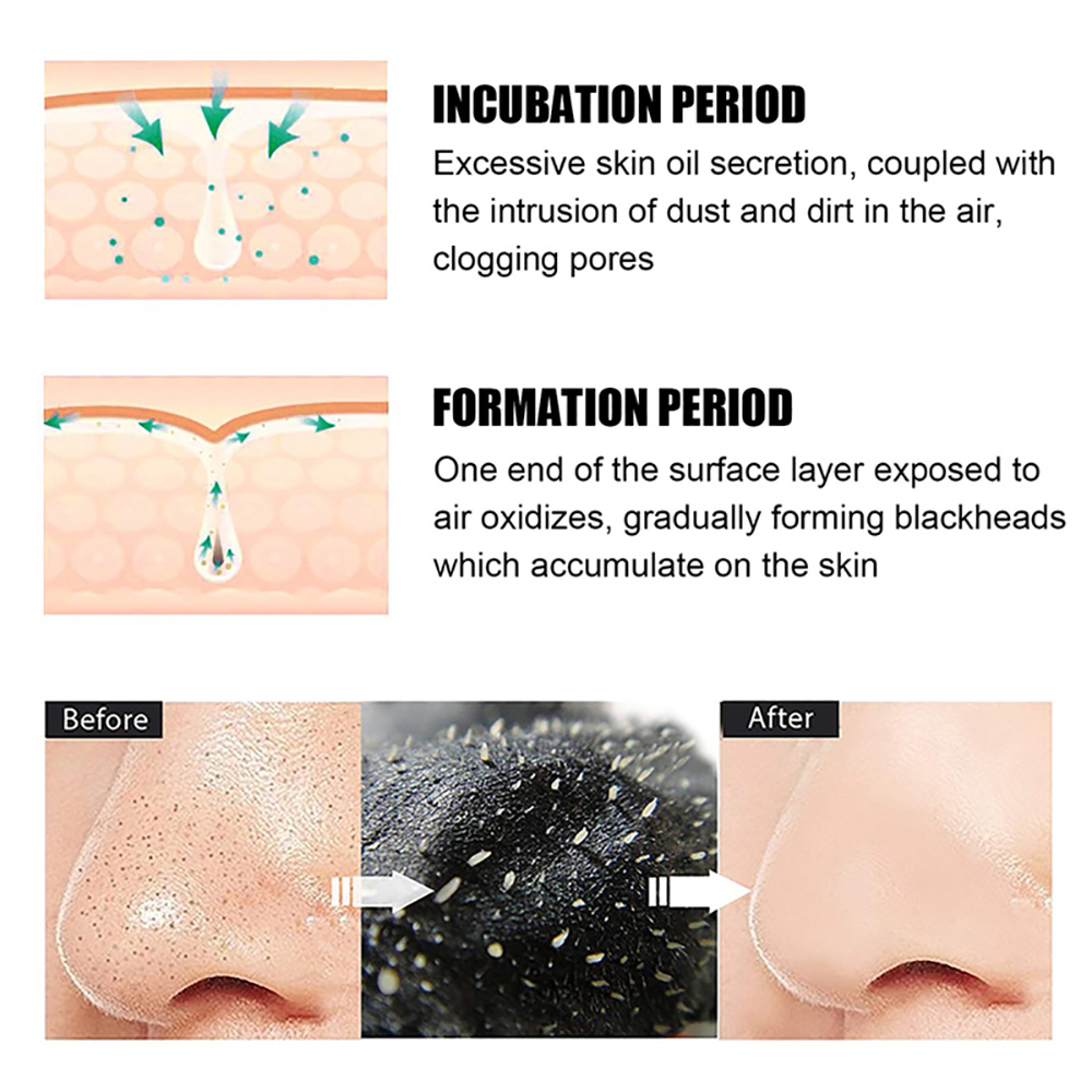 10-100Pcs Blackhead Remover Ma - Nasal Aspirator 评论和价格